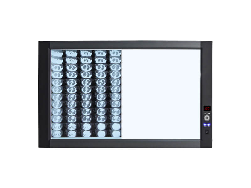 LED X-Ray Film Viewer (Sidelight Mode)