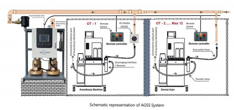 What Is an Anesthetic Gas Scavenging System (AGSS) - Amcaremed